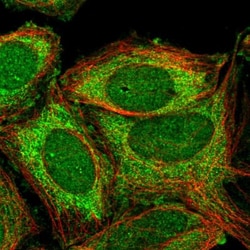 ZNF445 Antibody, Novus Biologicals 0.1mL; Unlabeled:Antibodies, Polyclonal